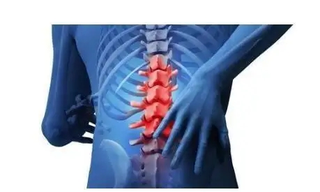 十人九腰痛，腰椎间盘的生理退变是怎么回事？插图1